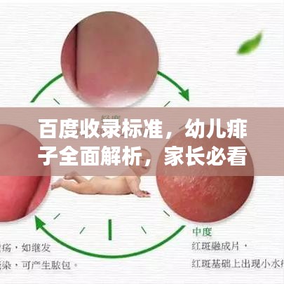 百度收录标准，幼儿痱子全面解析，家长必看！