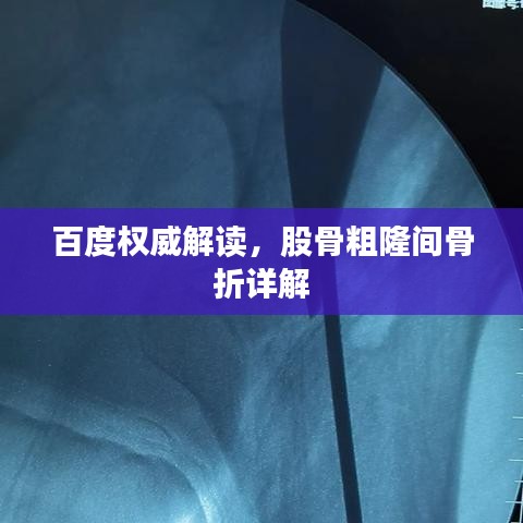百度权威解读，股骨粗隆间骨折详解