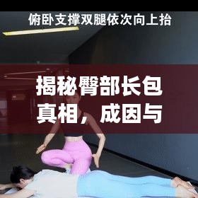 揭秘臀部长包真相，成因与应对方法，百度为您解答！